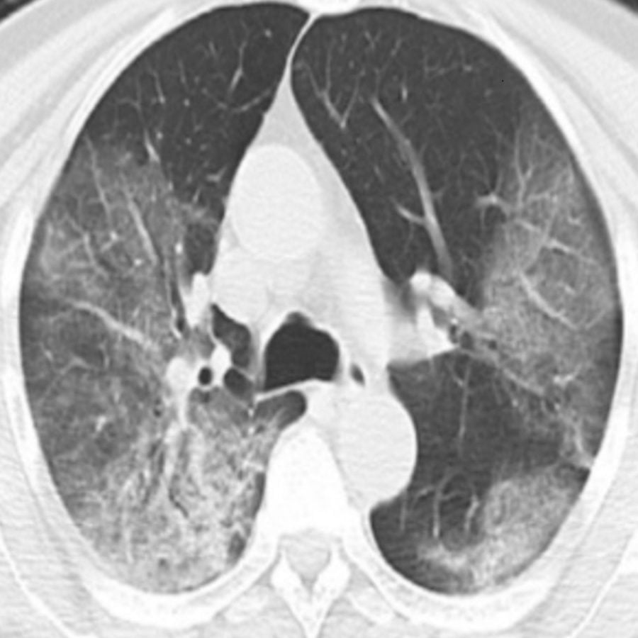 Abdominal x-ray: An imaging technology that is used to give an interior view of the abdomen in order to investigate issues.