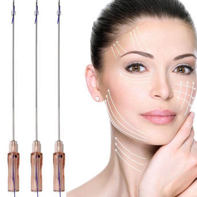 pdo thread lift: Procedure that lifts sagging skin. Alternative to facelift surgery.